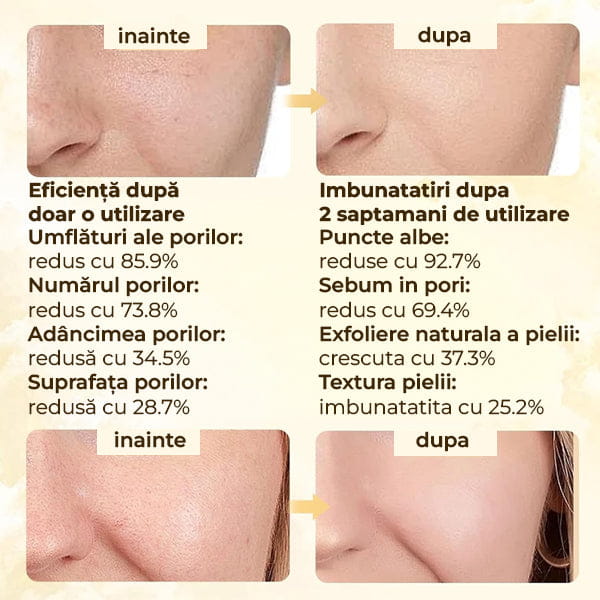 Set Seruri Exfoliere cu Niacinamida si Extract de Orez PEEL SHOT™