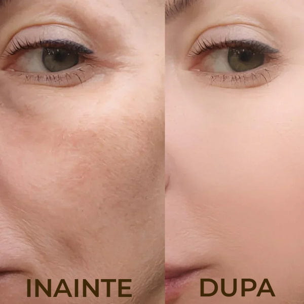 Set Seruri Exfoliere cu Niacinamida si Extract de Orez PEEL SHOT™