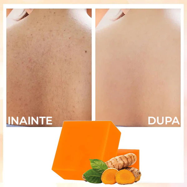 Sapun cu Turmeric pentru Pete Pigmentare si Acnee BODYLUX™