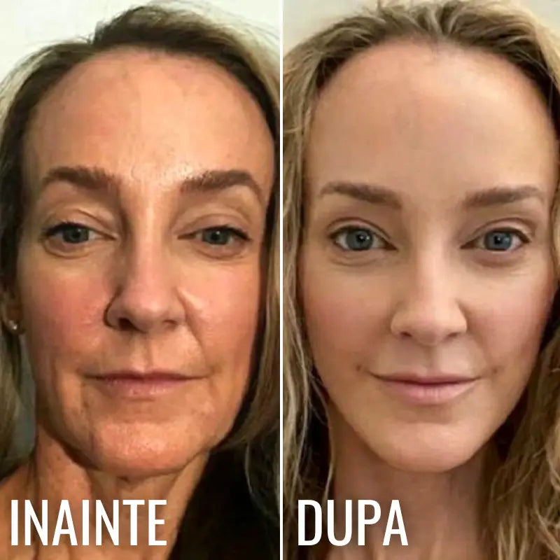 Ser Facial Intensiv cu Colagen & Peptide DEEP SKINLIFT™