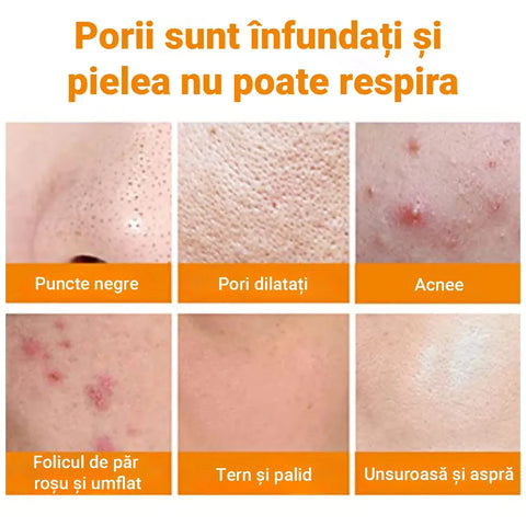 Set 12 Masti Faciale cu Extract de Morcov Bubble™