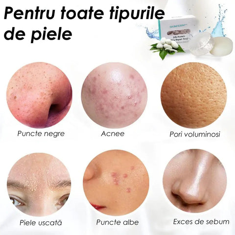 Sapun pentru Curatare Piele SkinFerm™