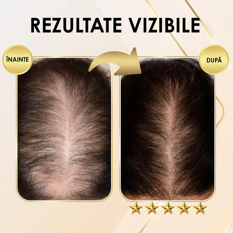 Sampon pentru Regenerarea Parului Ginger Secret™