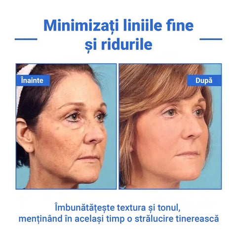 Ser Anti-Imbatranire cu Efect de Lifting BOTOX™
