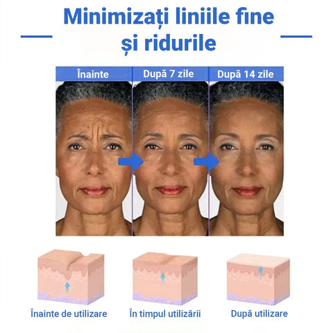 Ser Anti-Imbatranire cu Efect de Lifting BOTOX™