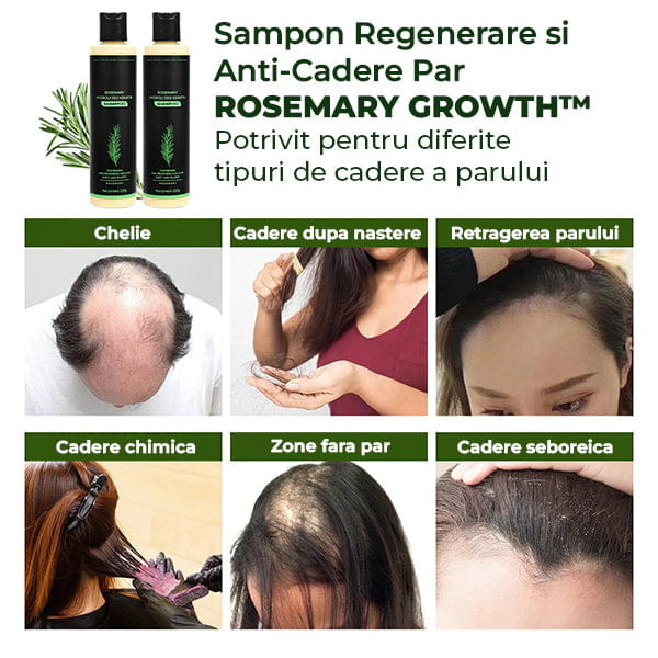 Sampon si Anti-Cadere ROSEMARY GROWTH™