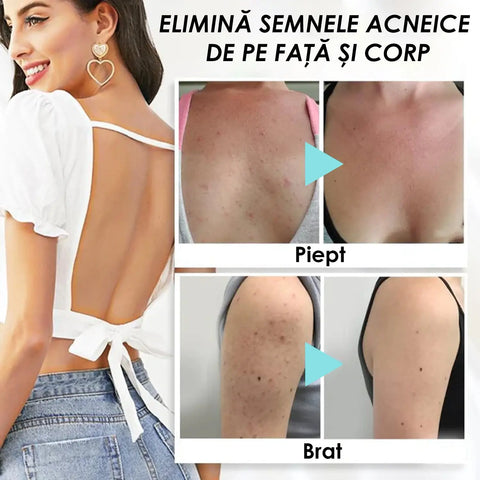 Sapun pentru Curatare Piele SkinFerm™