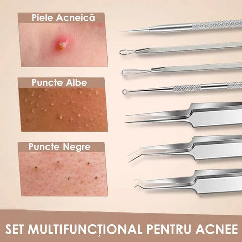 Set 8 Ustensile pentru Comedoane si Puncte Negre TWEEZ™