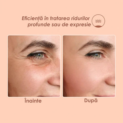 Balsam Facial Antirid cu Efect de Lifting Dr. DEROL™