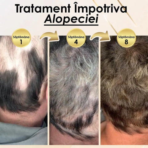 Sampon pentru Regenerarea Parului Ginger Secret™