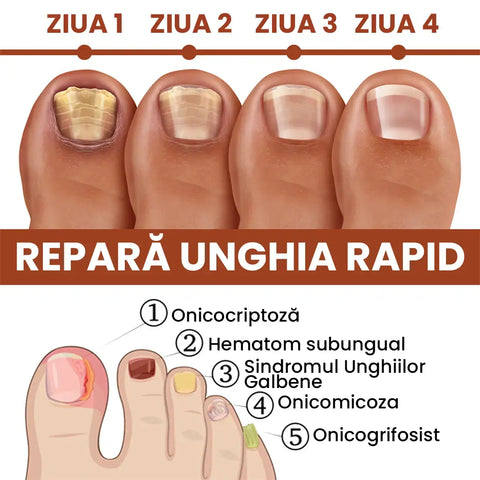 Ulei Regenerator si Reparator Unghii Ultra Nail™
