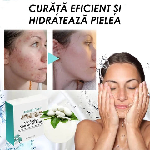 Sapun pentru Curatare Piele SkinFerm™