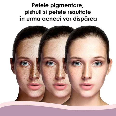 Gel cu Vitamina C SkinRenew™