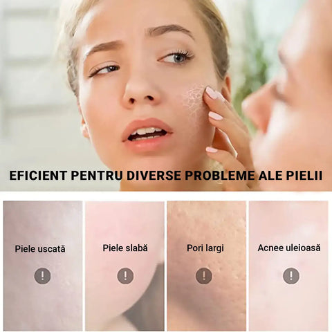 Crema pentru Fixare Bronz dupa Soare AFTERSUN™