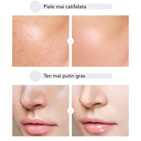 Ser Antirid cu Foite Aur 24K & Acid Hialuronic