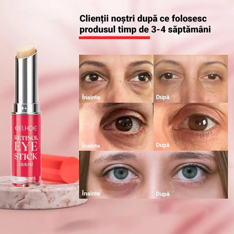 Baton Anti-Riduri cu Retinol EYE STYLE™
