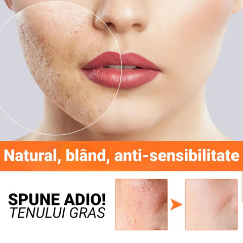 Set 12 Masti Faciale cu Extract de Morcov Bubble™