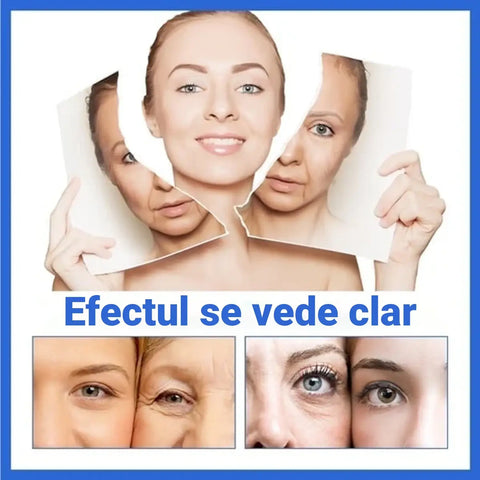 Ser Anti-Imbatranire cu Efect de Lifting BOTOX™