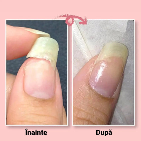 Gel Reparator Unghii + Lampa UV + Pensula FULLFIX ™