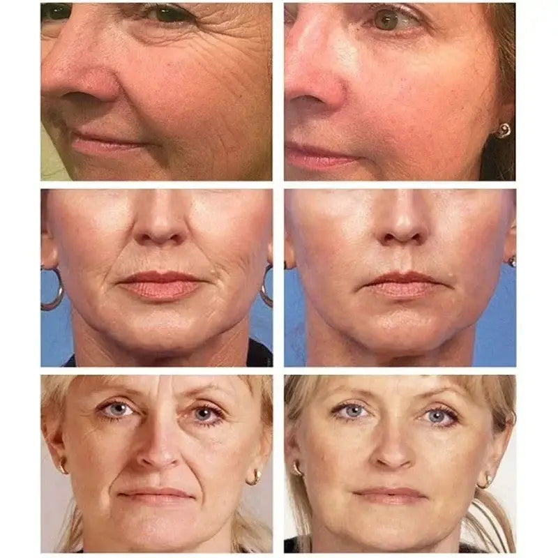 Set 9 Masti Colagen + 3 Seruri HYDRA SKIN™