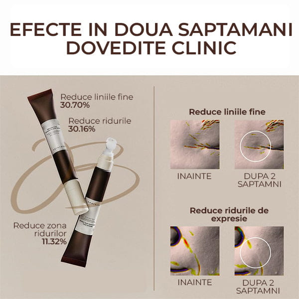 Crema Ochi Iluminatoare Anti Riduri si Cearcane CENTELLA PRO™