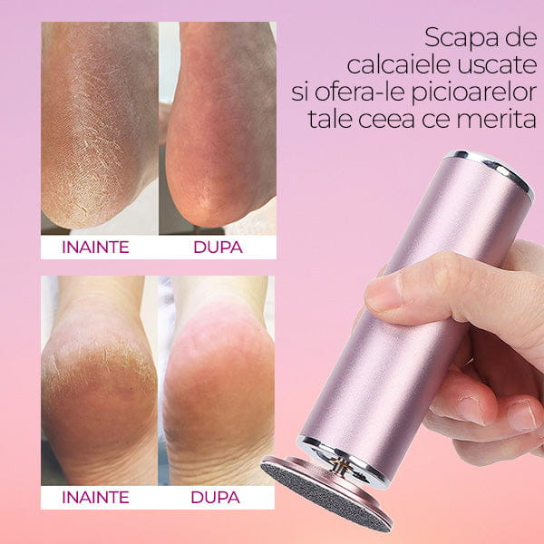 Dispozitiv Electric pentru Calcaie cu 60 Discuri PediLon™