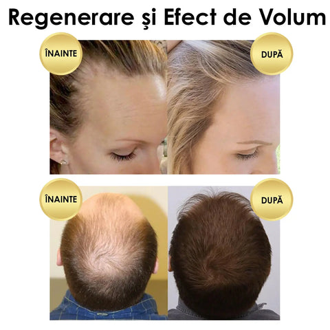 Sampon pentru Regenerarea Parului Ginger Secret™