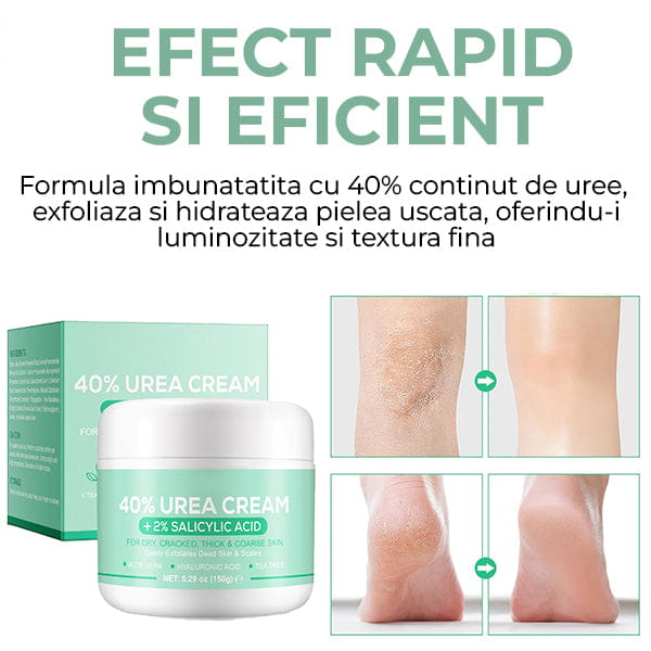 Crema pentru Picioare Perfect Catifelate Urea 40 PRO™