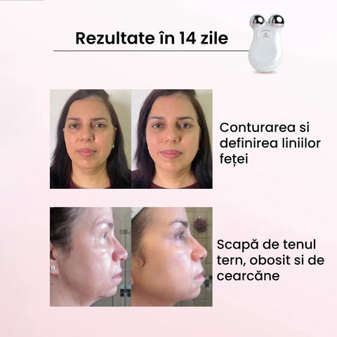Dispozitiv Lifting & Masaj Facial FACELIFT™