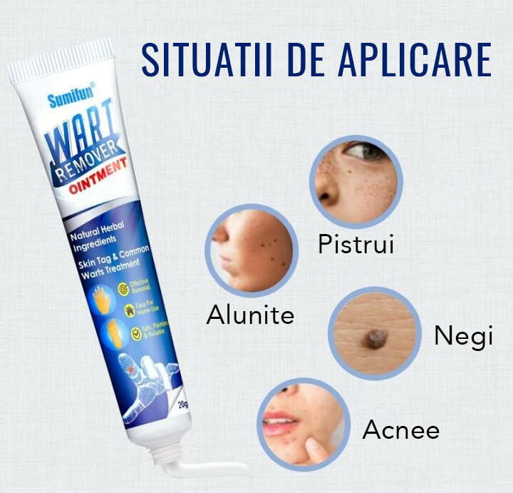 Crema Impotriva Negilor & Petelor Pigmentate WART PRO