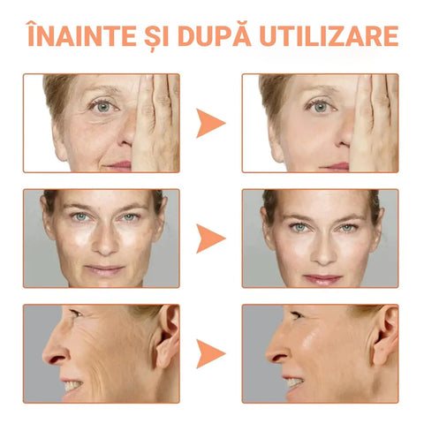 Ser Anti-Imbatranire cu Efect de Lifting BOTOX™