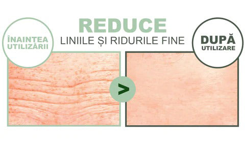 Set 20 Masti Faciale cu Colagen PURIME ™