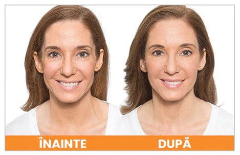 Set 10 Masti cu Colagen si Acid Hialuronic HIGHPRIME™