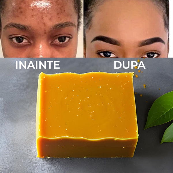 Sapun cu Turmeric pentru Pete Pigmentare si Acnee BODYLUX™