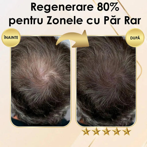 Sampon pentru Regenerarea Parului Ginger Secret™