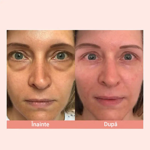 Baton Anti-Riduri cu Retinol EYE STYLE™