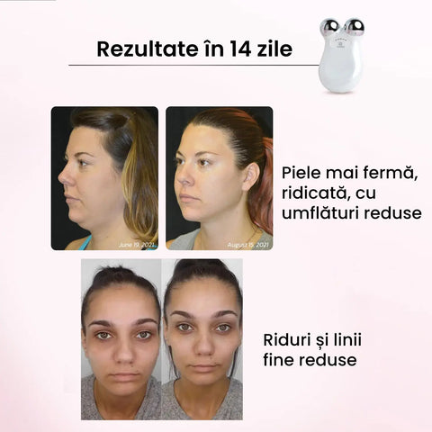 Dispozitiv Lifting & Masaj Facial FACELIFT™