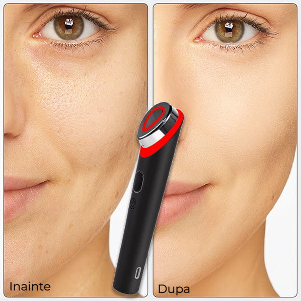 Dispozitiv Rejuvenare Faciala SKINBOOST 7 in 1 PRO™