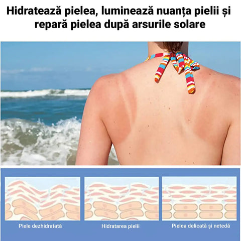 Crema pentru Fixare Bronz dupa Soare AFTERSUN™