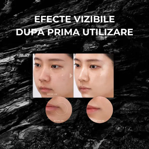 Capsule Faciale Stimulatoare si Hidratante Ceramide SKIN™