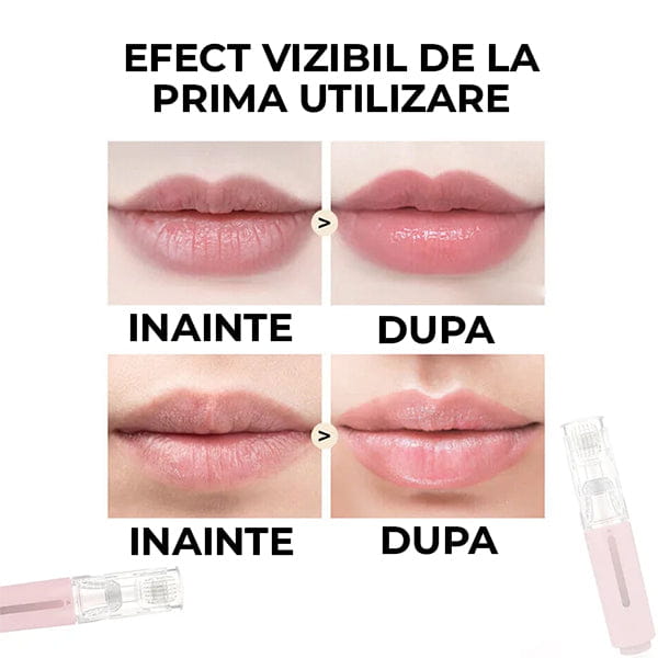 KIT pentru Super Volum Buze cu Derma Roller si Ser Cadou LIPSTAR™