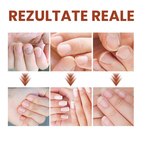 Ulei Regenerator si Reparator Unghii Ultra Nail™