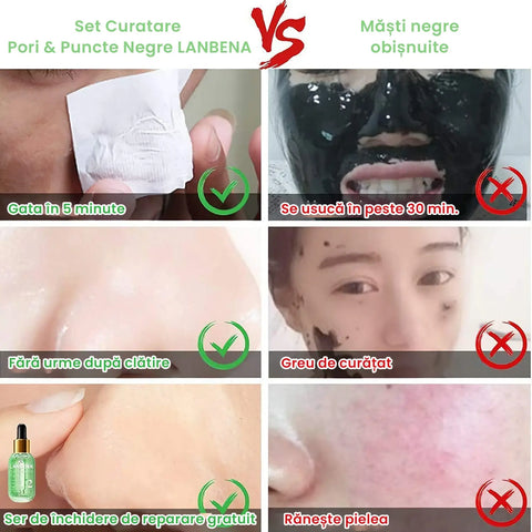 Set Curatare Pori & Puncte Negre LANBENA