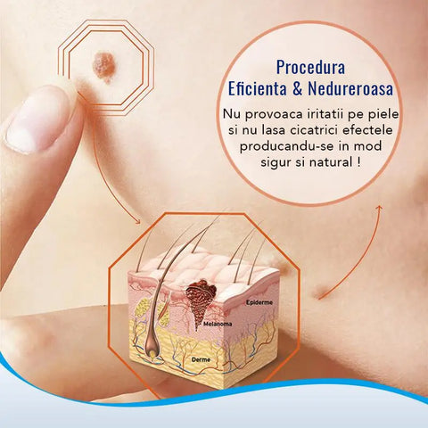 Pila Electrica pentru Calcaie si Unghii PediStar™