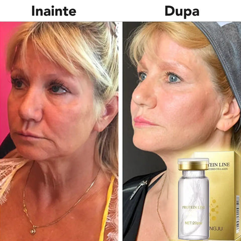 Set Lifting Facial KOREAN Gold Essence