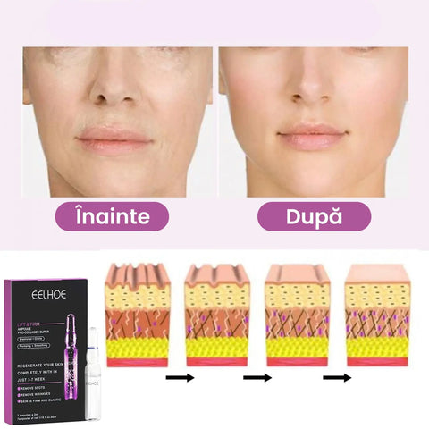 Set Seruri Anti-Imbatranire Collagen Be Youth™