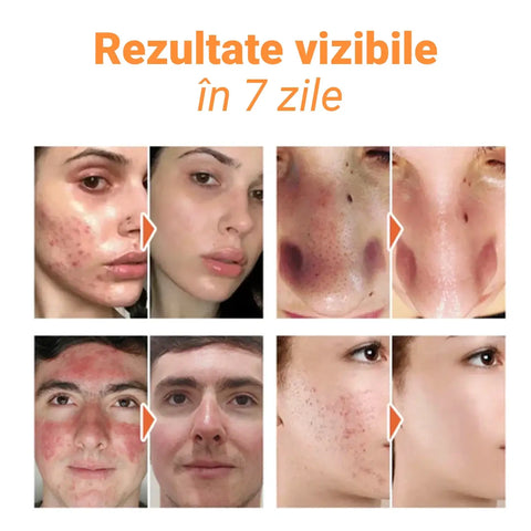 Set 12 Masti Faciale cu Extract de Morcov Bubble™