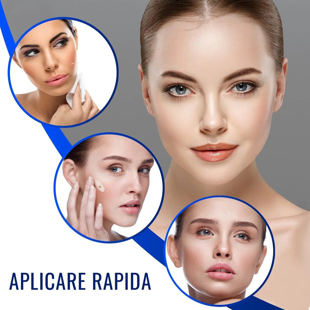 Crema Impotriva Negilor & Petelor Pigmentate WART PRO