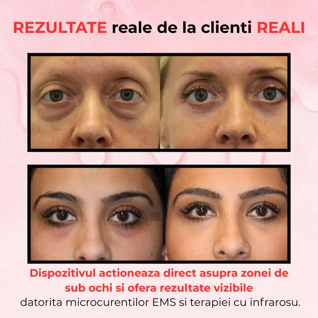 Dispozitiv Electric Anti-Cearcane & Riduri EYE PULSE™