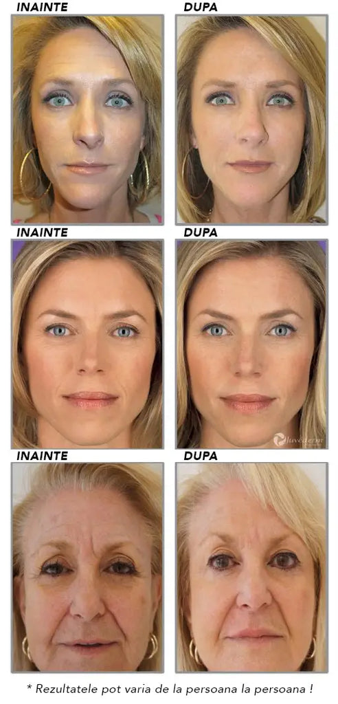 Capsule Faciale Stimulatoare si Hidratante Ceramide SKIN™